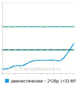 Средняя стоимость ректороманоскопия в Тюмени