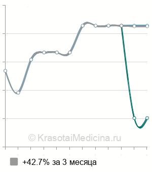 Средняя стоимость бронхоскопия в Тюмени