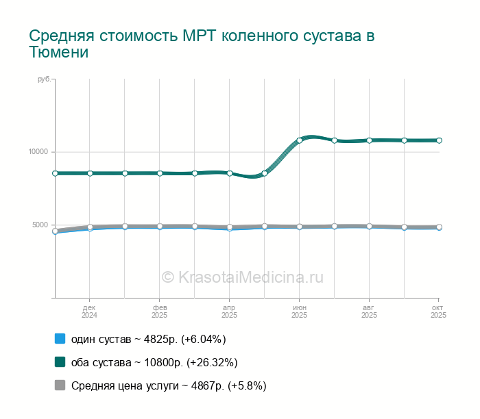 МРТ коленного сустава — цены от 152 руб. в Тюмени, 15 адресов